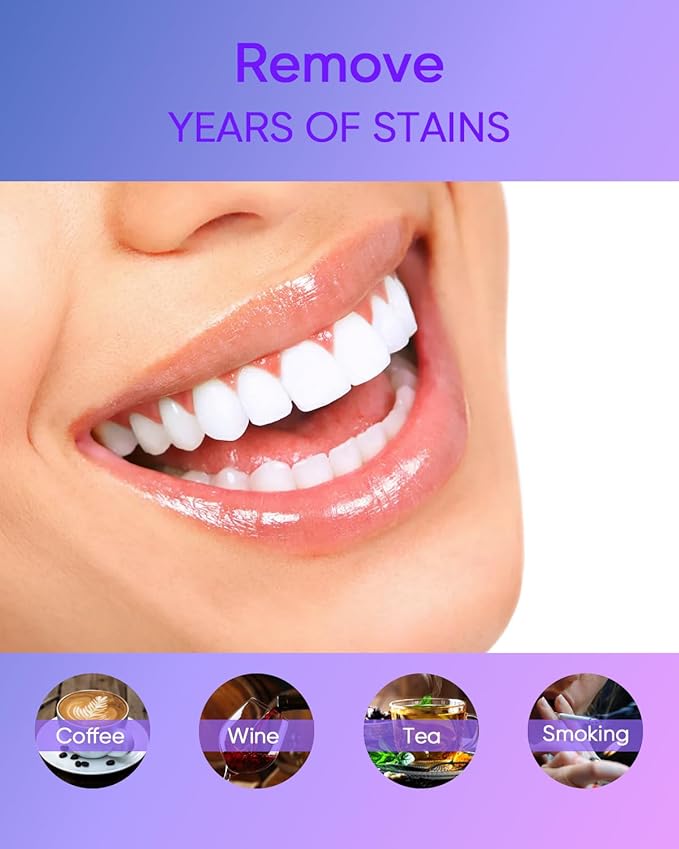 MySmile 4Pcs 35% Non-Sensitive Teeth Whitening Gel Refill Pack Kit for Whitening Teeth - Effective Painless Carbamide Peroxide Enamel Safety Mint Flavor Teeth Whitener(Not Include LED Mouth Tray)