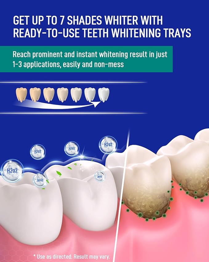 MySmile 7 Treatment Prefilled Teeth Whitening Trays 12% Hydrogen Peroxide and Fluoride Free Nano Hydroxyapatite Toothpaste Combo for Sensitive Teeth Relief, Enamel Repair and Teeth Remineralization