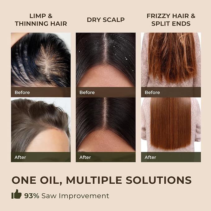 Gya Labs Rosemary Essential Oil for Hair - Huge 4 Fl Oz - 100% Pure Natural Rosemary Oil for Scalp, Diffuser, Skin, Aromatherapy & Candle Making Scent