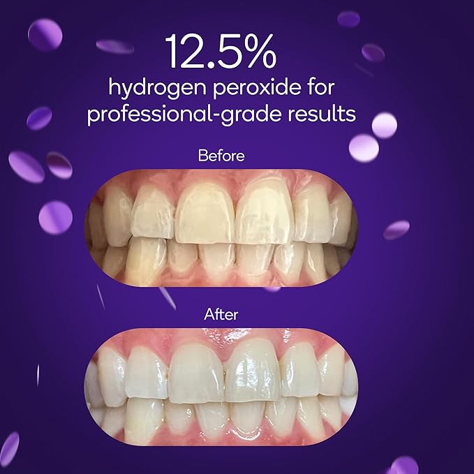 BURST Sensitive Teeth Friendly Whitening Kit | 3 Treatments with 12.5% Hydrogen Peroxide | Up to 3 Shades Whiter After First Use | Prefilled Gel Trays