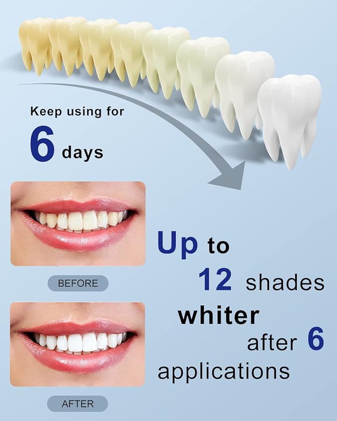 MySmile Teeth Whitening Strips Kit 14 Treatments with 28 LED Light - 10 Min Non-Sensitive Fast Whitening Teeth Enamel Safe Teeth Whitener - Helps to Remove Deep Stains