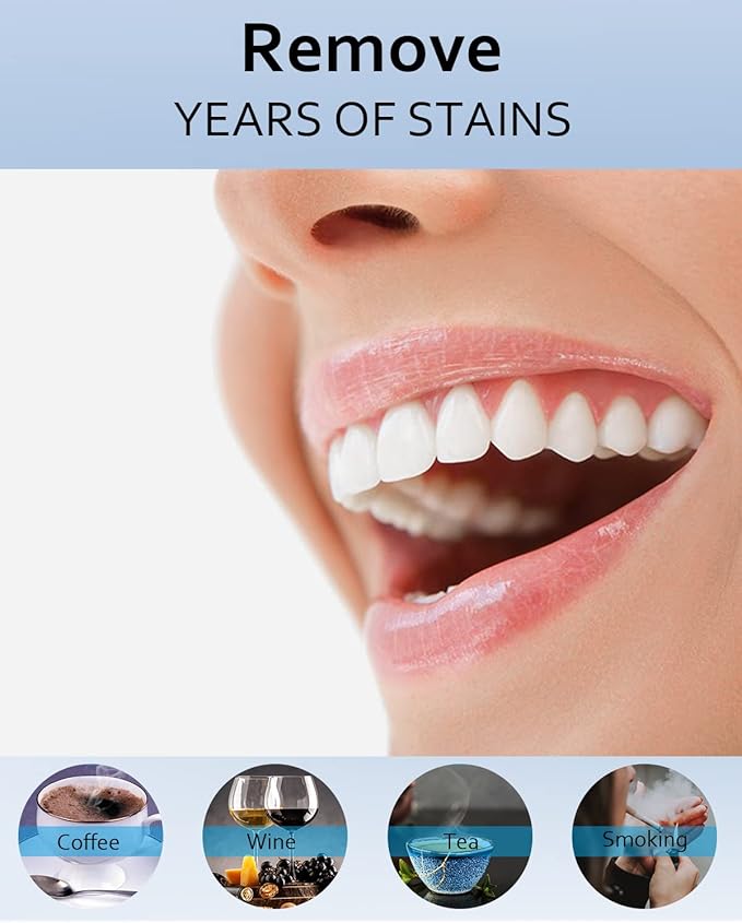 MySmile Teeth Whitening Gel Refills Pack, 6 Non-Sensitive Teeth Whitening Gel Pen, Teeth Whitener Dental Grade Tooth Whitening Gel for Tray, 10 min Fast Result Whitening