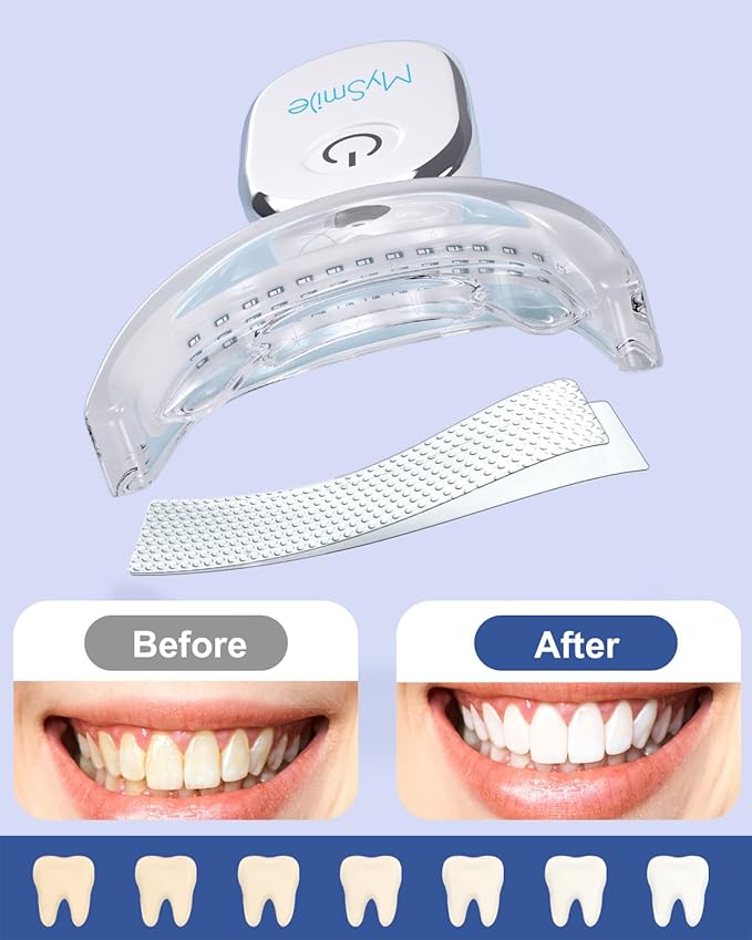 MySmile Teeth Whitening Strips Kit 14 Treatments with 28 LED Light - 10 Min Non-Sensitive Fast Whitening Teeth Enamel Safe Teeth Whitener - Helps to Remove Deep Stains