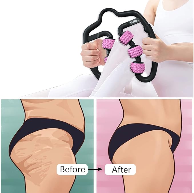 Cellulite Massage Tool Deep Fascia Massager & Dimpled Skin Remover for Legs - Anti-Cellulite Roller Tech with Lymphatic Drainage, Smooth Skin & Pain Relief for Thighs & Buttocks Sculpting