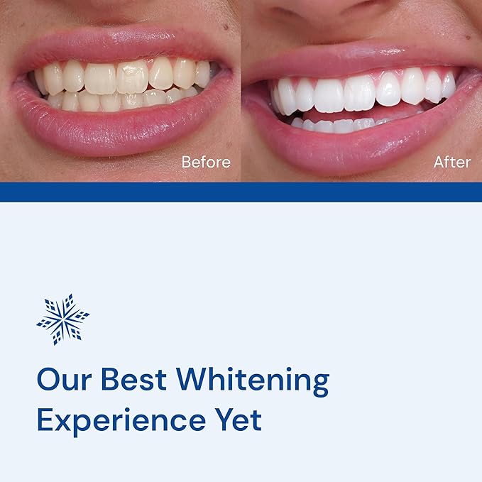 Snow Teeth Whitening Kit - Snow Teeth Whitening Serum and LED Mouthpiece Whitener, Formulated with Hydroxyapatite, Good for 2 Months - Wireless Kit with 1 Wand