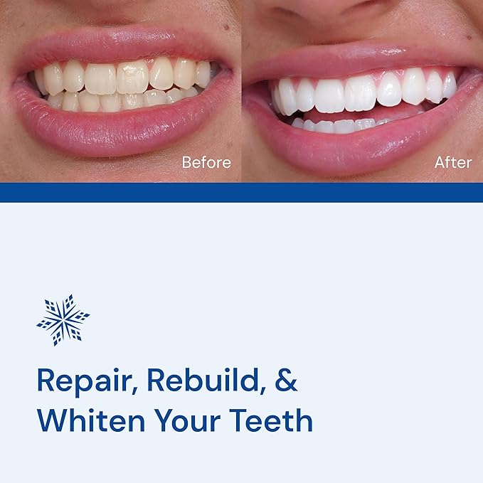 Snow Teeth Whitening Kit - Snow Teeth Whitening Serum and LED Mouthpiece Whitener, Formulated with Hydroxyapatite, Good for 2 Months - Wired Kit with 1 Wand