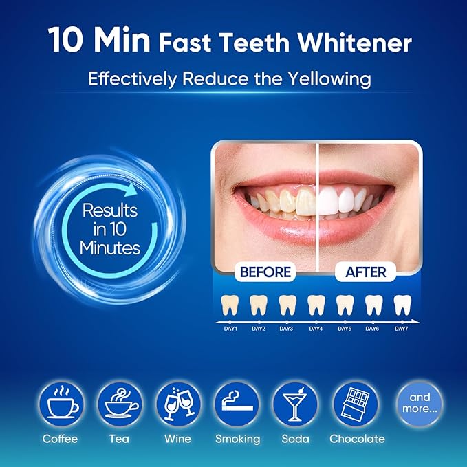 MySmile Teeth Whitening Kit for Sensitive Teeth with LED Light, 10 Min Non-Sensitive Fast Tooth Whitener, 3 Carbamide Peroxide Whitening Gel, Powerful Formula, Enamel Safe