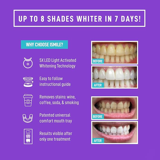 iSmile Teeth Whitening Kit - LED Light, 35% Carbamide Peroxide, (3) 3ml Gel Syringes, (1) Remineralization Gel, and Tray.