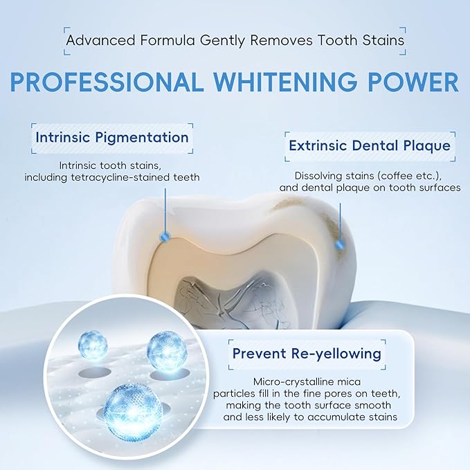 Teeth Whitening Gel- 60ml (2x30ml) Formulated for Sensitive Teeth | Plus Food-Grade Silicone Mouth Tray | Dentist Developed
