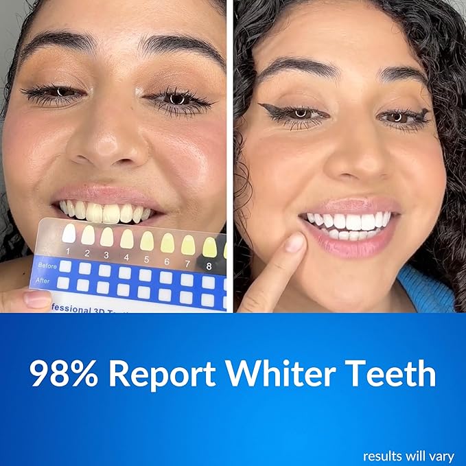 Polar MD Teeth Whitening Kit, Professional Teeth Whitener Gel Pens, 1YR. Supply, Compare to Whitening Strips. Powerful 32 LED Wireless Activating Light.